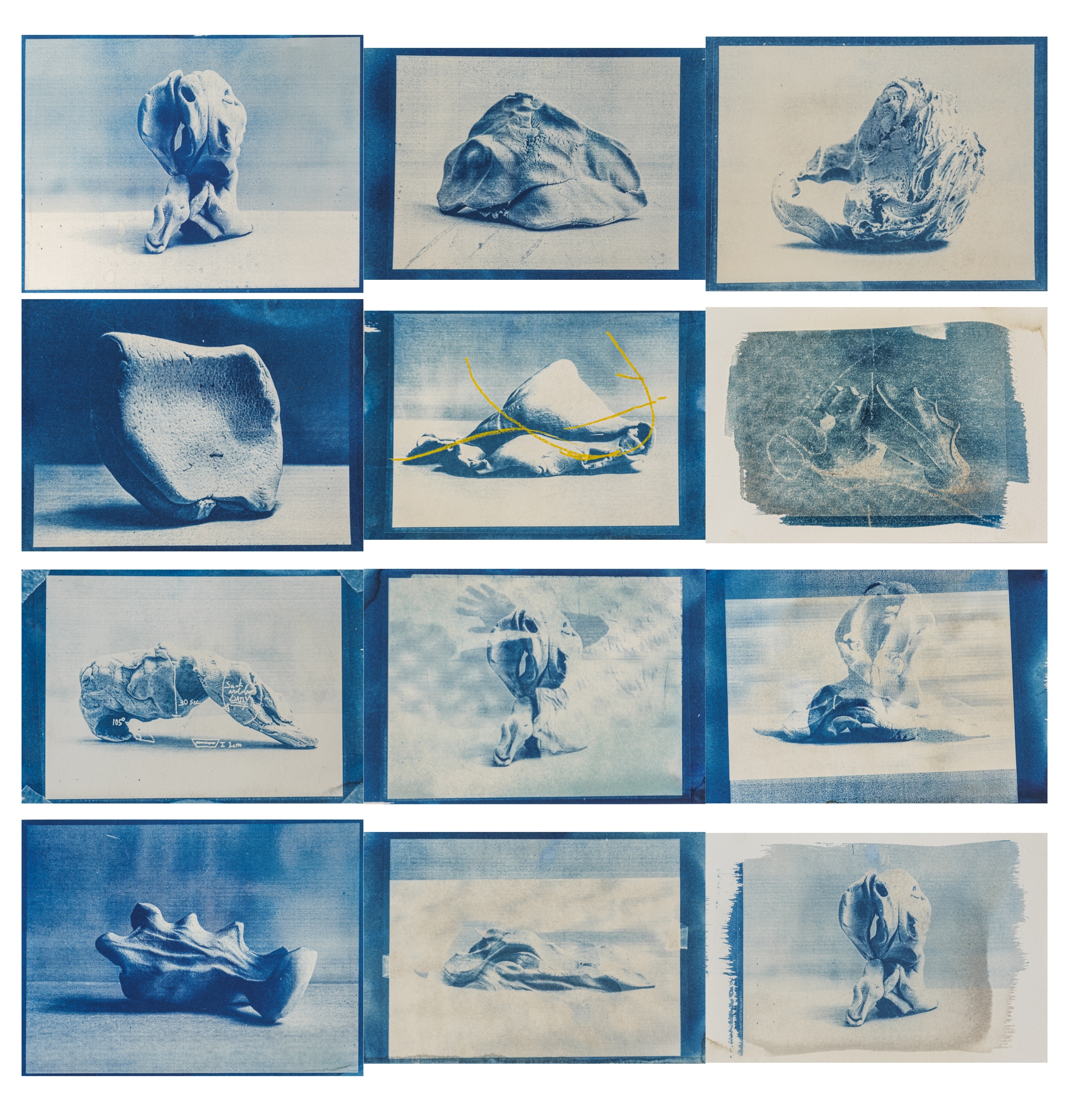 Excercise for body complication prevention. Claudia, Gura and Roee.  2024